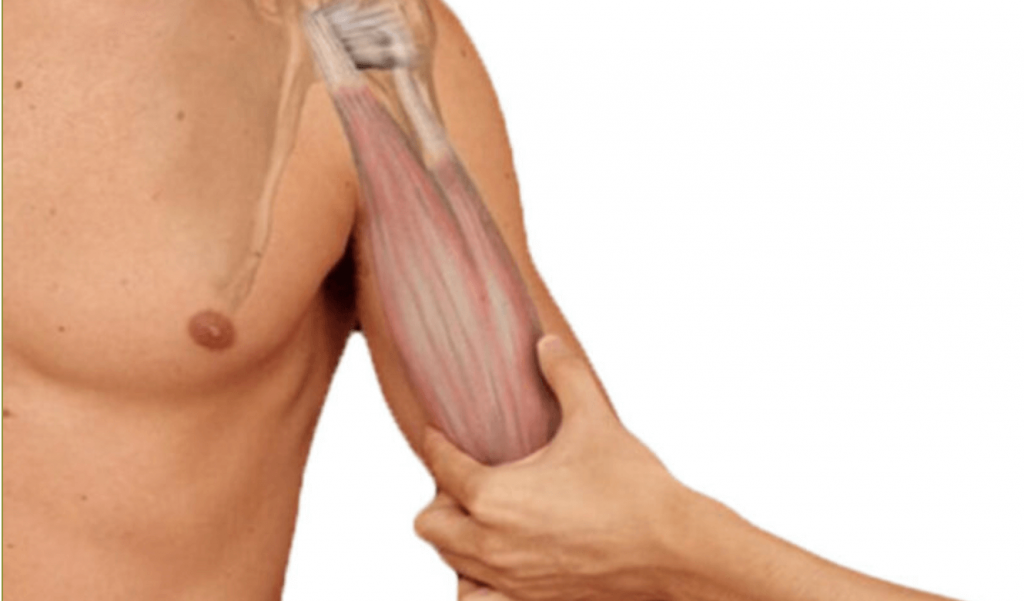 Bicepsklachten bovenarm fysiotherapie Middenweg