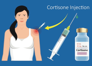 cortisone injectie schouder Fysiotherapie Middenweg